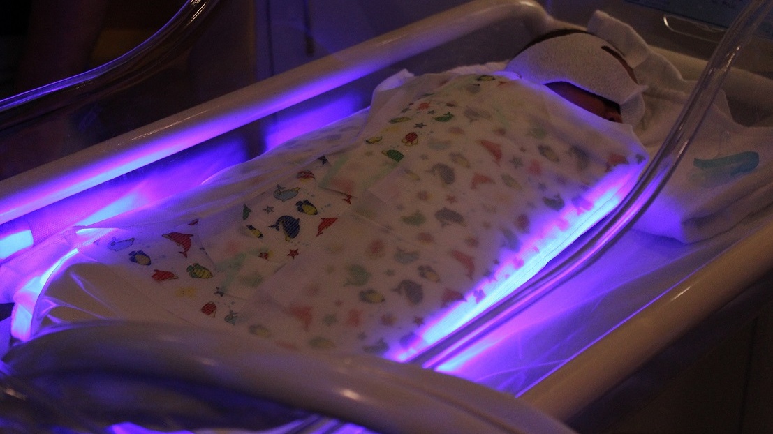 Home Phototherapy Keeping mothers and babies together  Northern Health